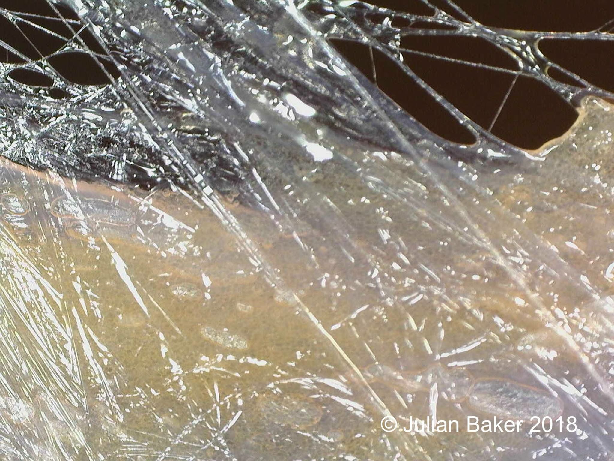 Fascia and hEDS Jeannie Di Bon