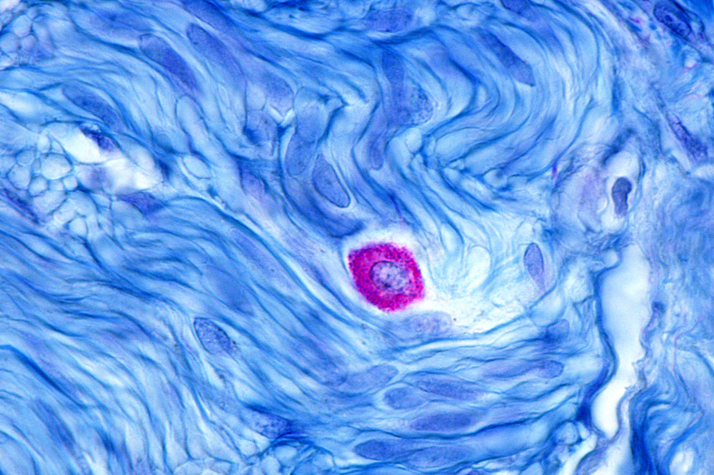 A stained microscopic image showing a mast cell in stained purple and full of granule, outside muscle fibers are stained blue