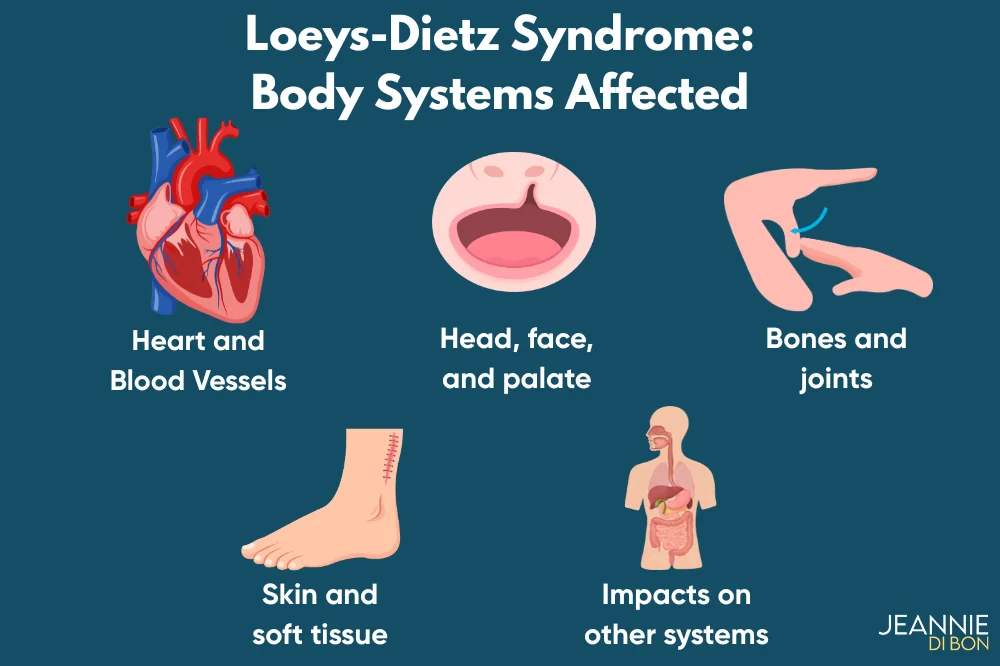 Infographic showing the five body systems affected by Loeys-Dietz syndrome: heart and blood vessels, head face and palate, bones and joints, skin and soft tissue, and impacts on other systems